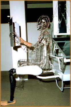 Prosthetic Man 01